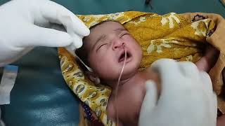 Nasogastric NGTube Insertion Suctioning NeonateNewbornOrogastricOGTube Feeding TubePaediatric [upl. by Catherina]