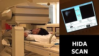 MY HIDA SCAN EXPERIENCE [upl. by Sacram588]