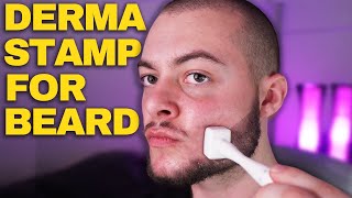 How To Derma Stamp Beard Properly Derma Stamp Tutorial Minoxidil amp Derma Stamp [upl. by Klump443]