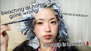 BLEACHING MY HAIR AT HOME WENT HORRIBLY WRONGbleach burnblood scabs and healing [upl. by Gow579]