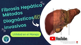 Fibrosis Hepática Métodos Diagnósticos no invasivos en el 2023  Utilidad en el Manejo [upl. by Anavi]