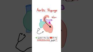 Aortic Regurgitation AR  Valvular Heart Disease VHD…biology science cardiology anatomy [upl. by Goto]