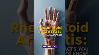 What Is Rheumatoid Arthritisfacts neet science pharmacy [upl. by Isador983]