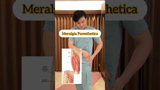 Rehabilitasi “Meralgia Paresthetica” 🫶🏻 pahakesemutan [upl. by Ladnor]