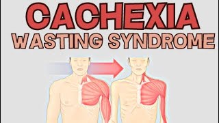 Cachexia  Wasting Syndrome  Explained [upl. by Annayat698]