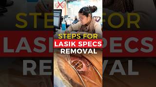 Steps For Lasik Specs Removal Surgery [upl. by Gerge]