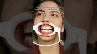 Dentist places lip retractor on girl for treatment [upl. by Zeke278]