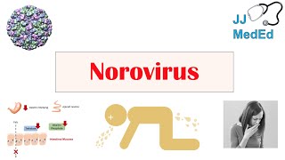 Norovirus Norwalk Virus  Transmission Pathogenesis Symptoms Prevention [upl. by Urban728]