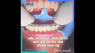 නවීන Invisalign මඟින් ඉදිරියට නෙරා ඇති දත් මාස 3කින් ස්ථිරවම සකසා ගමු [upl. by Kcirneh287]