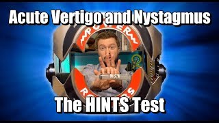 Acute Vertigo and Nystagmus HINTS Test [upl. by Athalee]