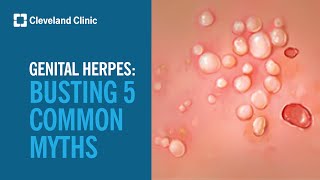 Busting 5 Myths About Genital Herpes [upl. by Ayokahs]