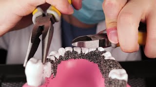 ASMR🦷 Dentist Pulls Your Bad Teeth [upl. by Atkins]