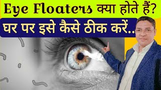 Eye Floaters क्या होते हैं घर पर इसे कैसे ठीक करें।  What are eye floaters cause and treatments [upl. by Nodababus]