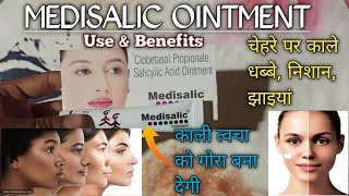 Medisalic Cream Review  Clobetasol Propionate Salicylic Acid Ointment  use and Benefits [upl. by Kerrill]