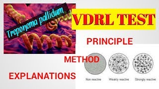 VDRL TestVDRL test procedureTreponema pallidum Microbilogysyphilis testSTDSTAR LABORATORY [upl. by Elijah]