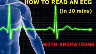 HOW TO READ AN ECG WITH ANIMATIONSin 10 mins [upl. by Inimak992]