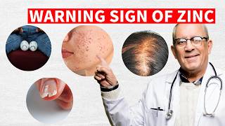 7 warning signs of a zinc deficiency  zinc deficiency  causes of zinc deficiency [upl. by Nowujalo646]