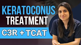 Treatment Of Keratoconus C3R TCAT C3R [upl. by Aicelef]