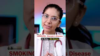 Smoking amp Buergers Disease  ICU Stories  Dr Richa Tiwari [upl. by Acnaiv]