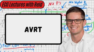 AV Reentry Tachycardia  Day 18 ECG Challenge [upl. by Kone]