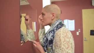 Alexandra Coppola Alopecia Story [upl. by Bryana97]