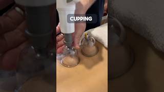 CUPPING amp ITS BENEFITS AT PHYSIOFLEX [upl. by Yeltrab]