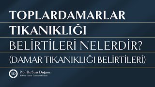 Toplardamarlar Tıkanıklığı Belirtileri Nelerdir Damar Tıkanıklığı Belirtileri [upl. by Neened]