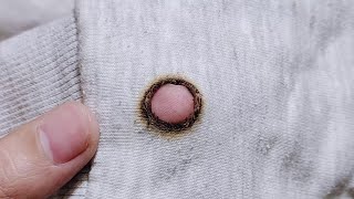 A new and ideal way to repair a hole in your clothes in a simple and easy way [upl. by Edmea]