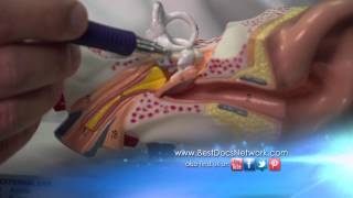 Middle Ear Reconstruction with Dallas Otologist Dr Yoav Hahn [upl. by Hecker]