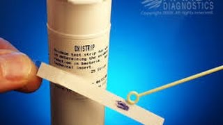 Microbiology oxidase test [upl. by Ridglea482]