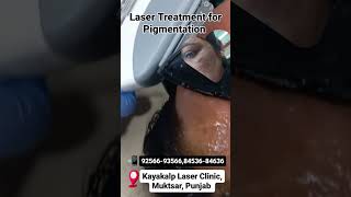 Pigmentation Removal Laser Treatment [upl. by Napier558]