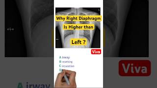 Diaphragm level  Diaphragm anatomy  MBBS  Anatomy  x ray  final year mbbs trending [upl. by Aidole490]