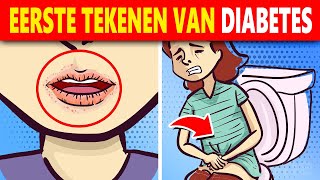 10 Vroege Tekenen En Symptomen Van Diabetes Waar Je Op Moet Letten [upl. by Itsyrc]