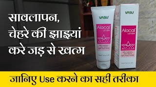 पुरानी से पुरानी झाइयों को जड़ से खत्म करे  Vasu Alacal Lotion [upl. by Nnagrom]