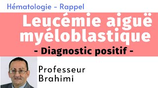 Leucémie Aiguë Myéloblastique Diagnostic positif [upl. by Diraf478]