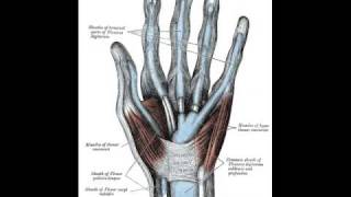 Flexor Tendon Sheath Infection [upl. by Charlie]