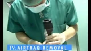 Airtraq Video Laryngoscope [upl. by Anirbas157]