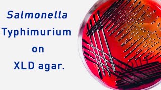 Xylose Lysine Deoxycholate XLD Agar A Biochemical Test for differentiations Shigella amp Salmonella [upl. by Simonetta]