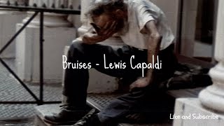 Lewis Capaldi  Bruises [upl. by Suehtomit206]