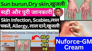 nuforce gm cream  nuforce gm  nuforce gm cream uses in telugu  nuforce gm cream kannada  Nuforce [upl. by Wendolyn]