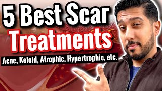 5 BEST Products for Scars  How to Get RID of Scars All Types [upl. by Jennica737]