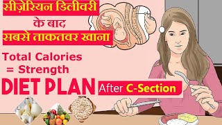 सिजेरियन डिलीवरी के बाद क्या खाये और क्या खाने से बचे  Diet Food After Cesarean Delivery [upl. by Kenlee762]