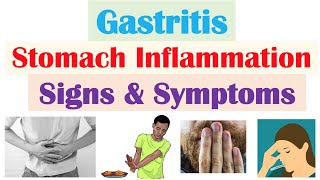 Gastritis Stomach Inflammation Signs amp Symptoms Complications amp Why They Occur [upl. by Edieh]