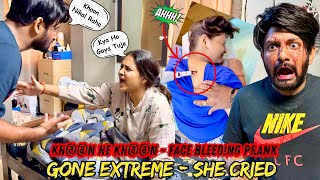 KH00N HE KH00N  SERIOUS FACE BL€€DING PRANK GONE EXTREME  EPIC REACTIONS [upl. by Nodnas490]