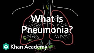 What is pneumonia  Respiratory system diseases  NCLEXRN  Khan Academy [upl. by Lisab682]