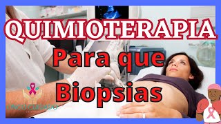 QUIMIOTERAPIA para que biopsias [upl. by Accebar]