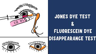 Understanding the Lacrimal Pump Mechanism  Jones Dye Test  FDDT Test [upl. by Brownson]