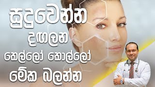 සුදුවෙන්න දඟලන කෙල්ලෝ කොල්ලෝ මේක බලන්න  Dr Namal Wijesinghe [upl. by Alexei]