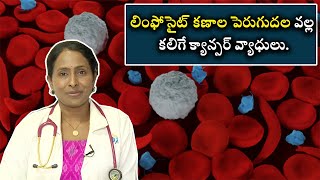 Cancerous Diseases Growth Of Lymphocyte Cells  లింఫోసైట్ కణాల పెరుగుదల వల్ల క్యాన్సర్ వ్యాధులు [upl. by Inafetse840]