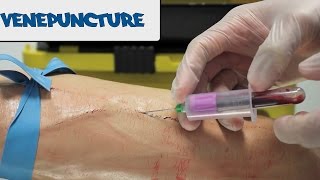 Venipuncture  How to take Blood  OSCE Guide old version  UKMLA  CPSA [upl. by Benedicta]